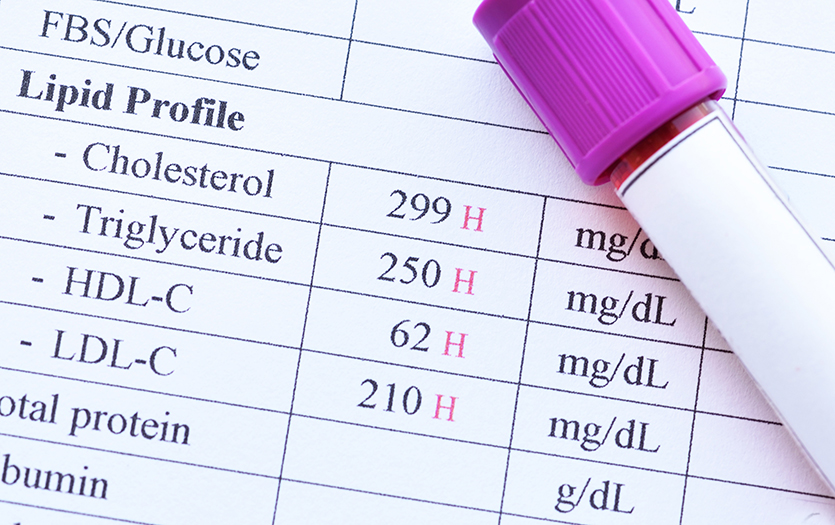 A printed lipid panel lab report with a blood collection tube resting on it.